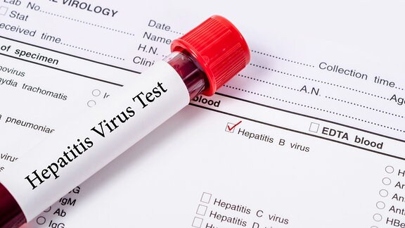 Ein Hepatitis Virus Test liegt auf einem Formular.