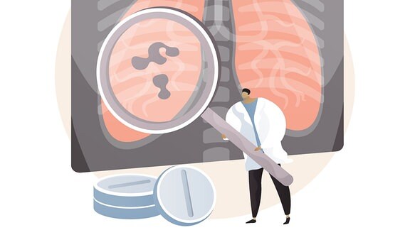 Illustration zeigt Tabletten und Mediziner mit Lupe vor Lunge